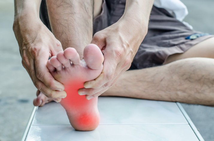 Plantar Fasciitis