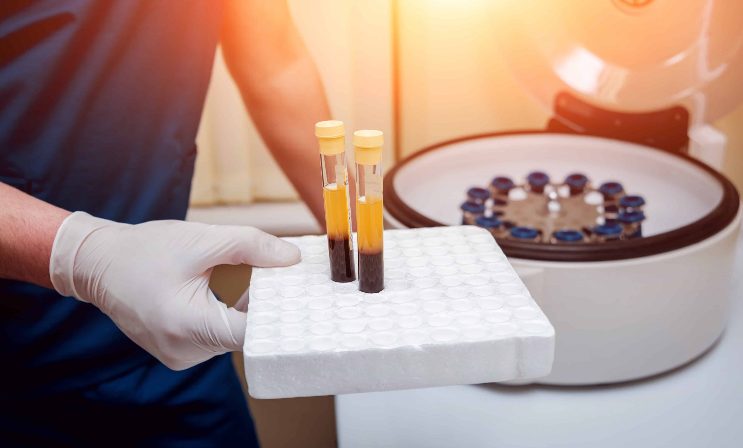 PRP Injections PRP Injections