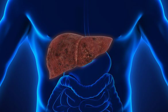 fatty liver disease